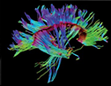 Brain MRI