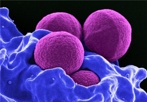 Staphylococcus Aureus (MRSA)