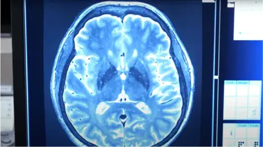 X-ray of what looks like a brain (Video)