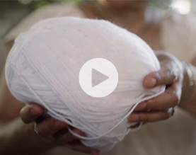 Pic: Fighting Cancer with a Ball of Yarn