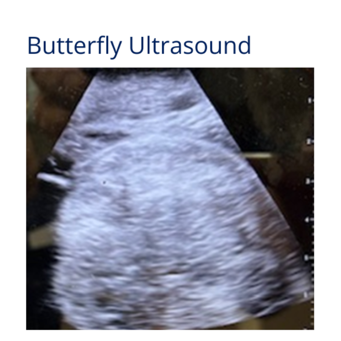 Ultrasound image