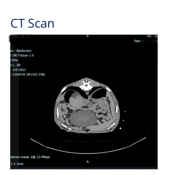 image of a CT scan