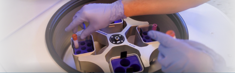 Watch Video: Hope for Mike